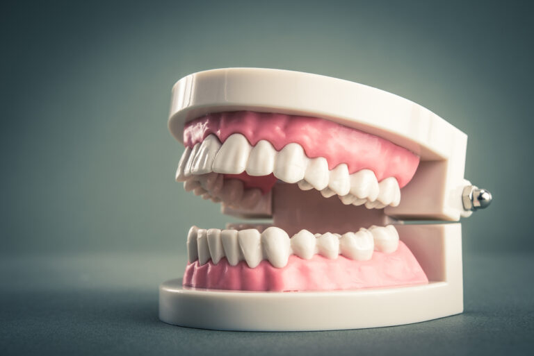 Periodontal Maintenance loveland